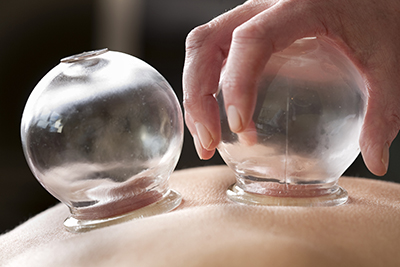 cupping muscle therapy marblehead ma